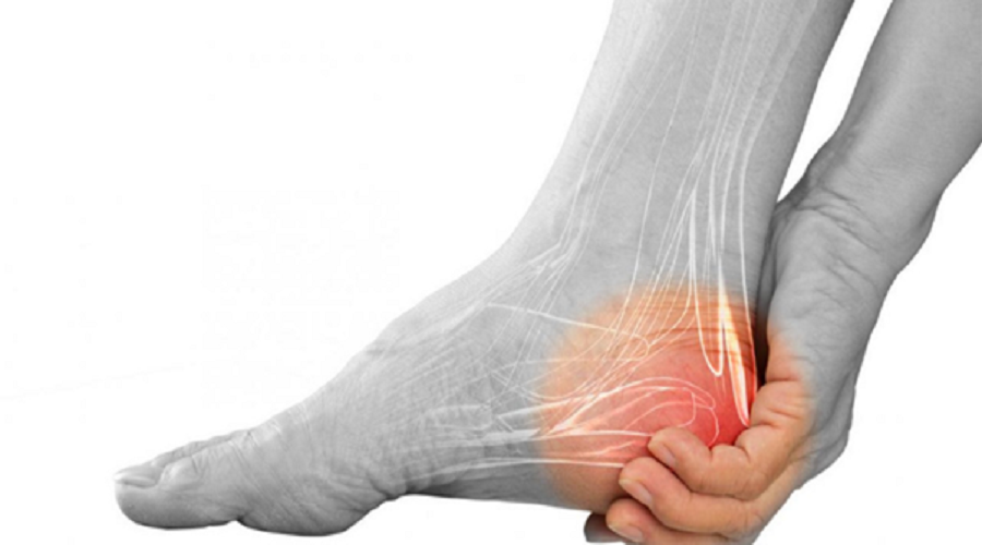 Tendinopatia tibiale | patologia del piede